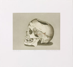 Dr. R.’s Skull (State II)